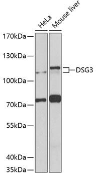Western blot - DSG3 Polyclonal Antibody 