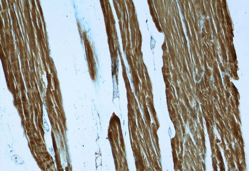 Immunohistochemistry of paraffin-embedded human skeletal muscle slide using Catalog No:107704(ACTA1-Specific Antibody) at dilution of 1:50