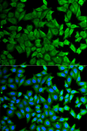 Immunofluorescence - KLKB1 Polyclonal Antibody 