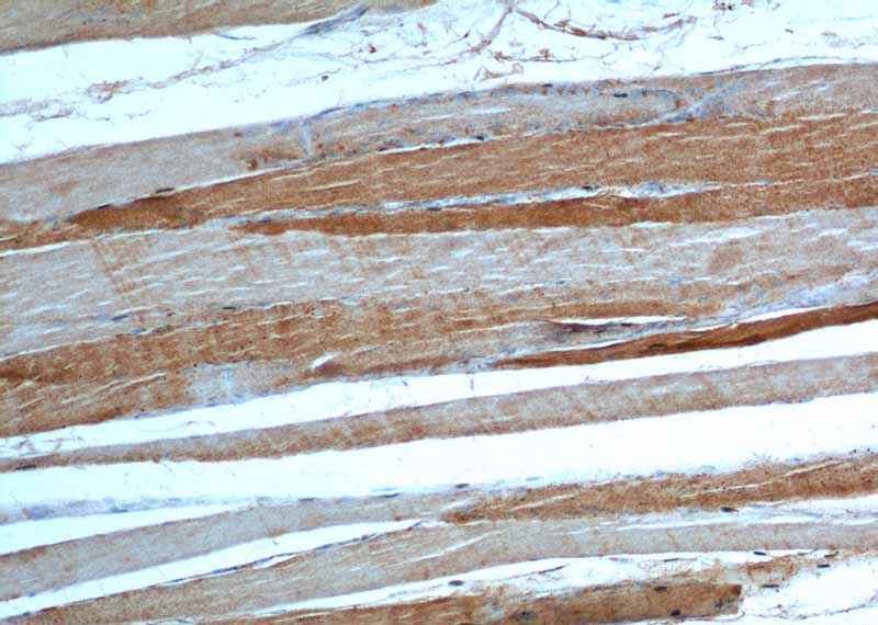Immunohistochemistry of paraffin-embedded human skeletal muscle tissue slide using Catalog No:116568(ULK1 Antibody) at dilution of 1:200 (under 10x lens).