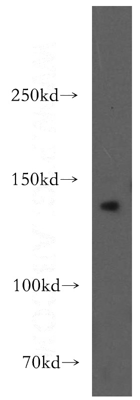 mouse brain tissue were subjected to SDS PAGE followed by western blot with Catalog No:107988(AMBRA1 antibody) at dilution of 1:300
