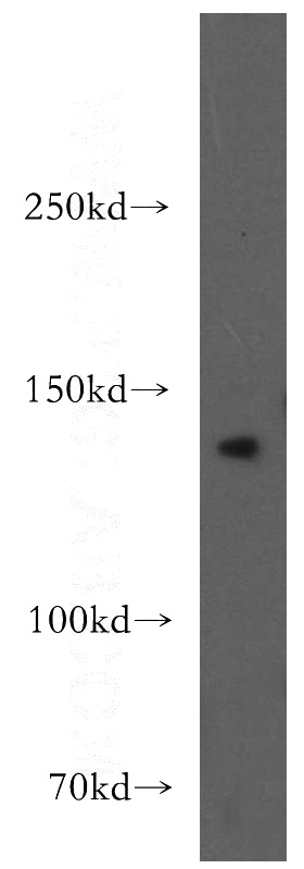 mouse brain tissue were subjected to SDS PAGE followed by western blot with Catalog No:107988(AMBRA1 antibody) at dilution of 1:300