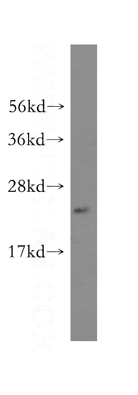 K-562 cells were subjected to SDS PAGE followed by western blot with Catalog No:109067(PDCD10 antibody) at dilution of 1:300