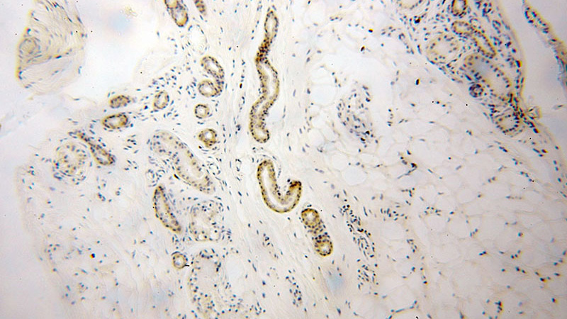 Immunohistochemical of paraffin-embedded human skin using Catalog No:116524(UBE2F antibody) at dilution of 1:100 (under 10x lens)