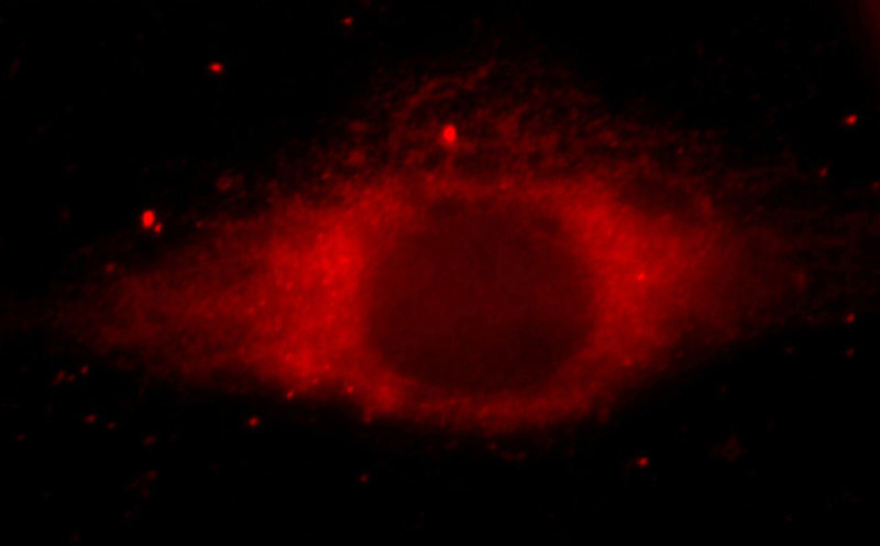 Immunofluorescent analysis of Hela cells, using FAM111B antibody Catalog No:110459 at 1:25 dilution and Rhodamine-labeled goat anti-rabbit IgG (red).