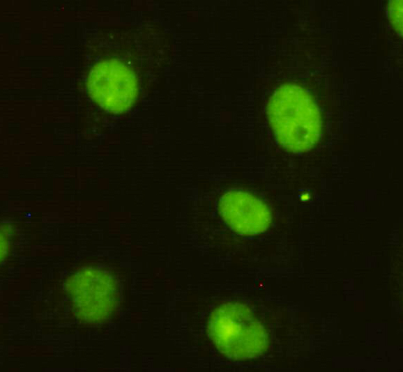 Immunocytochemistry of HeLa cells using anti-DBC1 mouse mAb diluted 1:200.