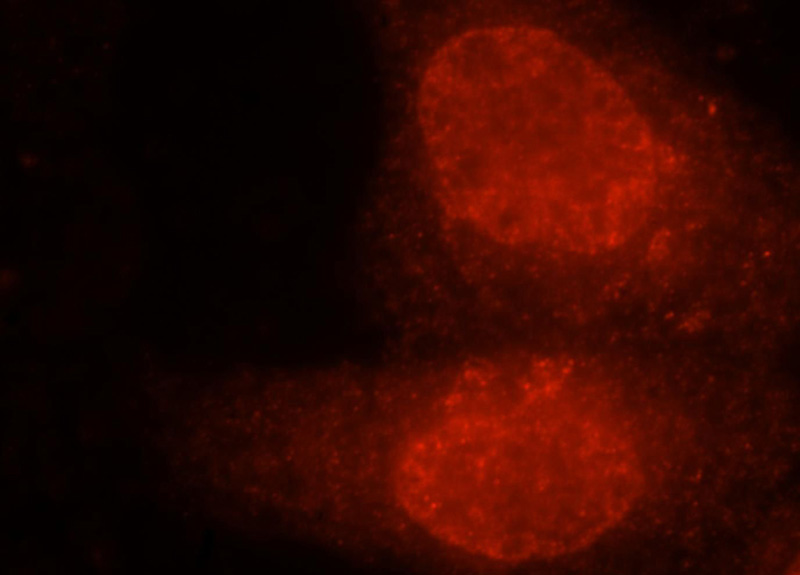 Immunofluorescent analysis of HepG2 cells, using EXOSC4 antibody Catalog No:110411 at 1:25 dilution and Rhodamine-labeled goat anti-rabbit IgG (red).
