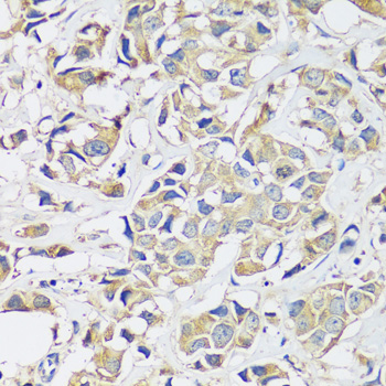 Immunohistochemistry - BLOC1S3 Polyclonal Antibody 