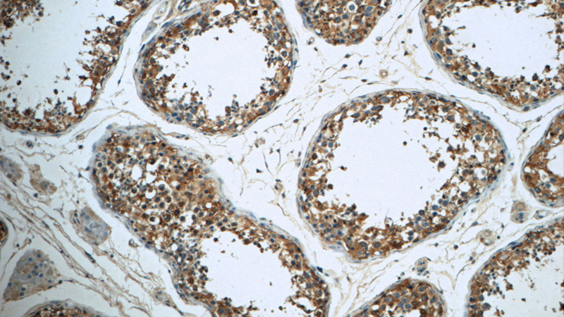 Immunohistochemistry of paraffin-embedded human testis tissue slide using Catalog No:113473(PAAF1 Antibody) at dilution of 1:50 (under 10x lens)