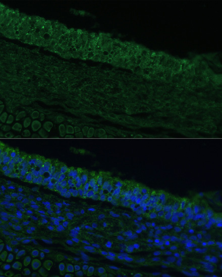 Immunofluorescence - IL25 Polyclonal Antibody 