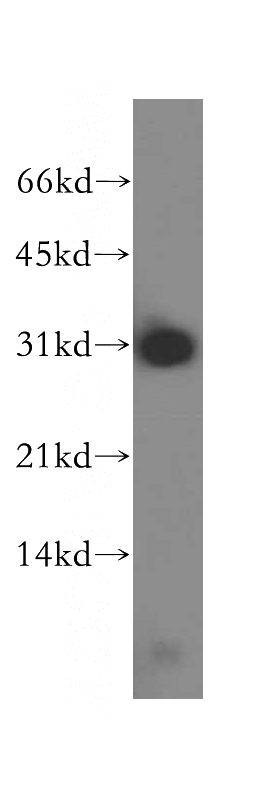 HepG2 cells were subjected to SDS PAGE followed by western blot with Catalog No:114247(PSME2 antibody) at dilution of 1:500