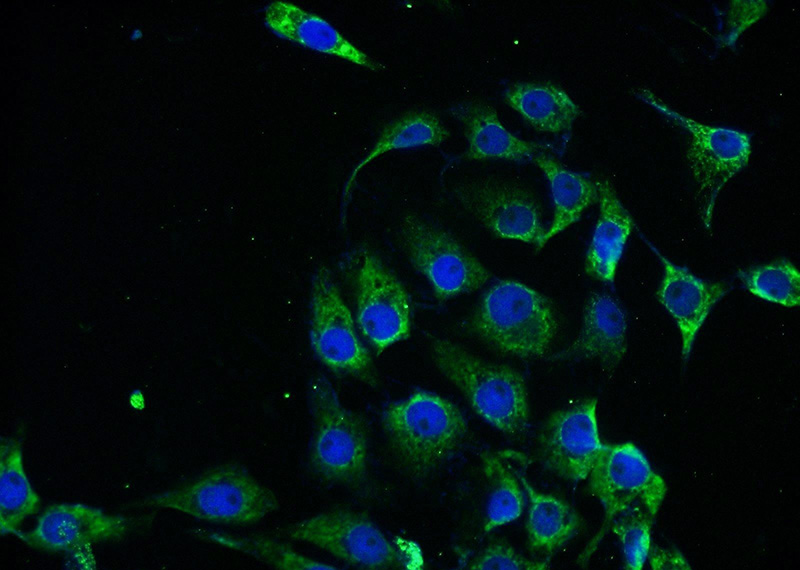 Immunofluorescent analysis of SH-SY5Y cells using Catalog No:114100(PPP2R2B Antibody) at dilution of 1:25 and Alexa Fluor 488-congugated AffiniPure Goat Anti-Rabbit IgG(H+L)