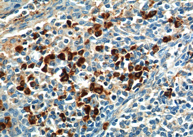 Immunohistochemistry of paraffin-embedded human tonsillitis tissue slide using Catalog No:111119(GPR171 Antibody) at dilution of 1:200 (under 40x lens). heat mediated antigen retrieved with Tris-EDTA buffer(pH9).