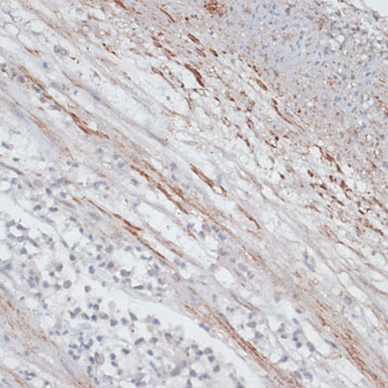 Immunohistochemistry - TPM1 Polyclonal Antibody 
