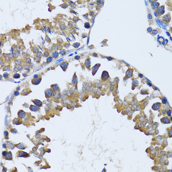 Immunohistochemistry - HDAC5 Polyclonal Antibody 