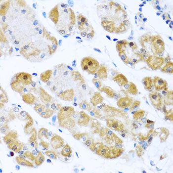 Immunohistochemistry - RPS2 Polyclonal Antibody 