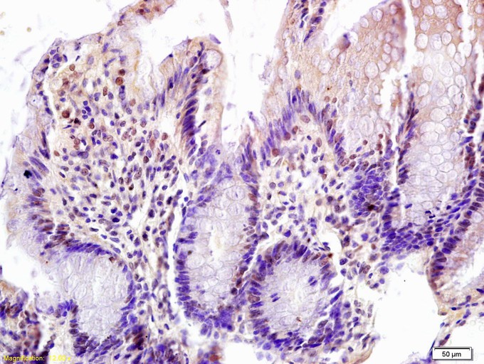 Fig1: Tissue/cell: rat colon tissue; 4% Paraformaldehyde-fixed and paraffin-embedded;; Antigen retrieval: citrate buffer ( 0.01M, pH 6.0 ), Boiling bathing for 15min; Block endogenous peroxidase by 3% Hydrogen peroxide for 30min; Blocking buffer (normal goat serum,C-0005) at 37℃ for 20 min;; Incubation: Anti-FOXN1 Polyclonal Antibody, Unconjugated 1:200, overnight at 4℃, followed by conjugation to the secondary antibody(SP-0023) and DAB(C-0010) staining