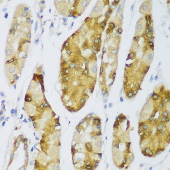 Immunohistochemistry - ERLIN1 Polyclonal Antibody 