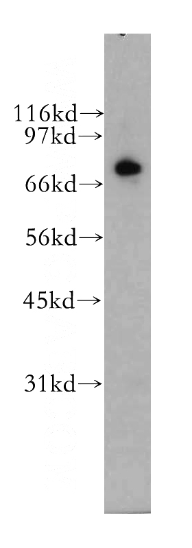human brain tissue were subjected to SDS PAGE followed by western blot with Catalog No:114551(RAPGEF5 antibody) at dilution of 1:500