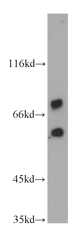human brain tissue were subjected to SDS PAGE followed by western blot with Catalog No:114552(RAPGEFL1 antibody) at dilution of 1:500