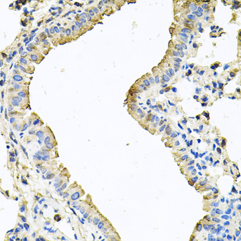 Immunohistochemistry - CHCHD3 Polyclonal Antibody 