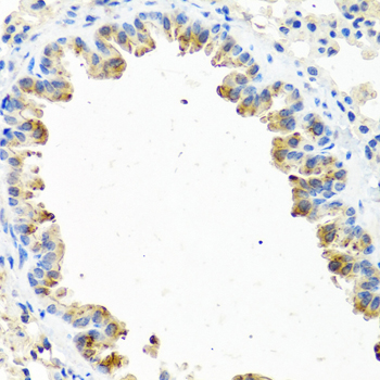 Immunohistochemistry - GNRH2 Polyclonal Antibody 