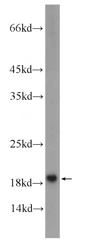rat brain tissue were subjected to SDS PAGE followed by western blot with Catalog No:115449(SNAPIN Antibody) at dilution of 1:200