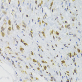Immunohistochemistry - DOK1 Polyclonal Antibody 
