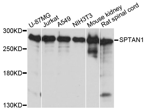 Western blot - SPTAN1 Polyclonal Antibody 