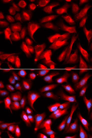 Immunofluorescence - HMMR Polyclonal Antibody 