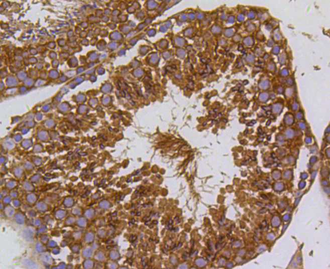 Immunohistochemistry - PIK3R3 Monoclonal Antibody 