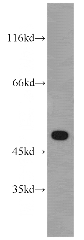 A549 cells were subjected to SDS PAGE followed by western blot with Catalog No:110298(EDAR antibody) at dilution of 1:1200