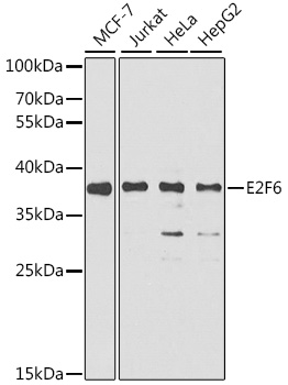 Western blot - E2F6 Polyclonal Antibody 