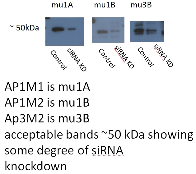 WB result of AP1M2 antibody (Catalog No:108118;1:500) with siRNA cell lysate.
