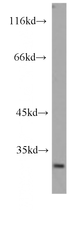 HeLa cells were subjected to SDS PAGE followed by western blot with Catalog No:107485(PHB antibody) at dilution of 1:500