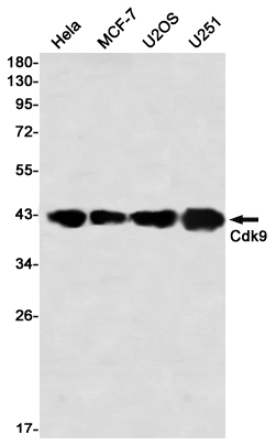 Western blot detection of Cdk9 in Hela,MCF-7,U2OS,U251 using Cdk9 Rabbit mAb(1:1000 diluted)