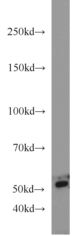 HeLa cells were subjected to SDS PAGE followed by western blot with Catalog No:113707(PEPD antibody) at dilution of 1:600