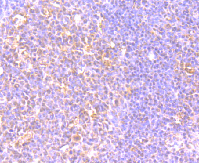 Fig2:; Immunohistochemical analysis of paraffin-embedded human tonsil tissue using anti-LY75 antibody. The section was pre-treated using heat mediated antigen retrieval with Tris-EDTA buffer (pH 9.0) for 20 minutes.The tissues were blocked in 1% BSA for 30 minutes at room temperature, washed with ddH; 2; O and PBS, and then probed with the primary antibody ( 1/50) for 30 minutes at room temperature. The detection was performed using an HRP conjugated compact polymer system. DAB was used as the chromogen. Tissues were counterstained with hematoxylin and mounted with DPX.