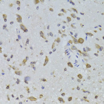 Immunohistochemistry - RPL13 Polyclonal Antibody 