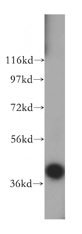 human brain tissue were subjected to SDS PAGE followed by western blot with Catalog No:113092(NECAP1 antibody) at dilution of 1:500