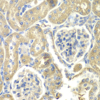 Immunohistochemistry - OAZ1 Polyclonal Antibody 