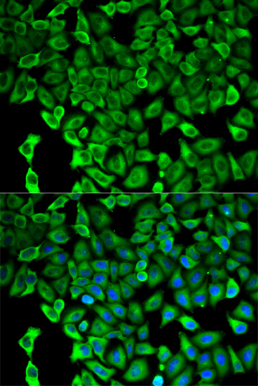Immunofluorescence - PSMD2 Polyclonal Antibody 