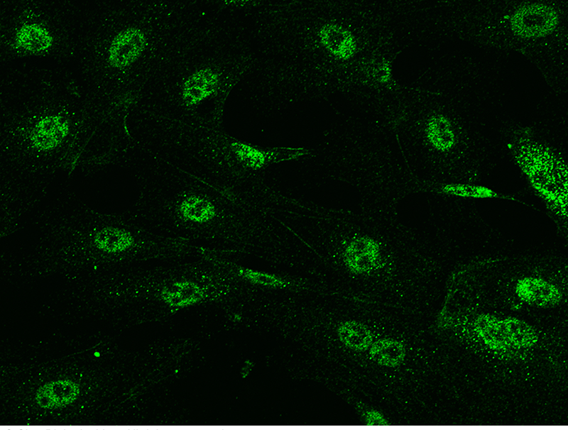 Human DAPK3/ZIPK Immunofluorescence(IF) 15438