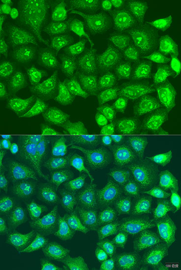 Immunofluorescence - SPICE1 Polyclonal Antibody 
