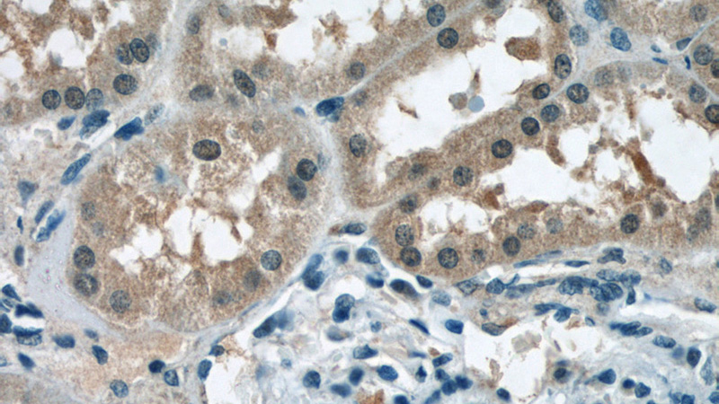 Immunohistochemistry of paraffin-embedded human kidney tissue slide using Catalog No:107929(AKAP11-Specific Antibody) at dilution of 1:50 (under 40x lens)
