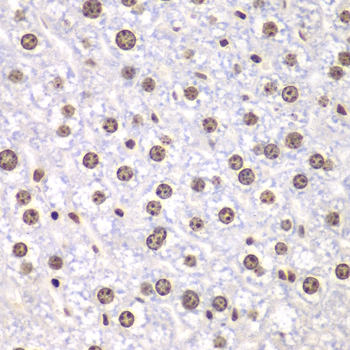 Immunohistochemistry - TOP1 Polyclonal Antibody 