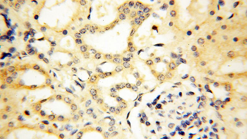 Immunohistochemical of paraffin-embedded human kidney using Catalog No:111750(IL9 antibody) at dilution of 1:50 (under 40x lens)