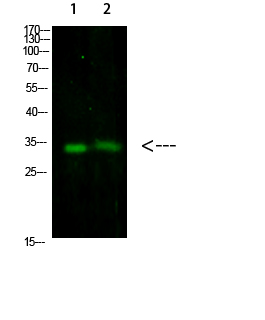 Fig1:; Western Blot analysis of 1,293T 2,mouse-brain cells using primary antibody diluted at 1:1000(4°C overnight). Secondary antibody: Goat Anti-rabbit IgG IRDye 800( diluted at 1:5000, 25°C, 1 hour)
