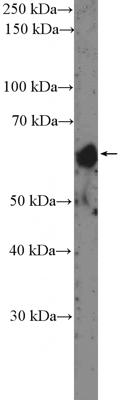 human placenta tissue were subjected to SDS PAGE followed by western blot with Catalog No:115574(SPINT1 Antibody) at dilution of 1:300