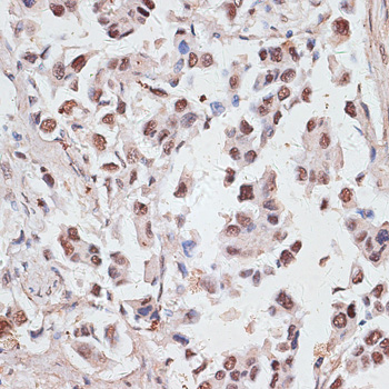 Immunohistochemistry - DKC1 Polyclonal Antibody 